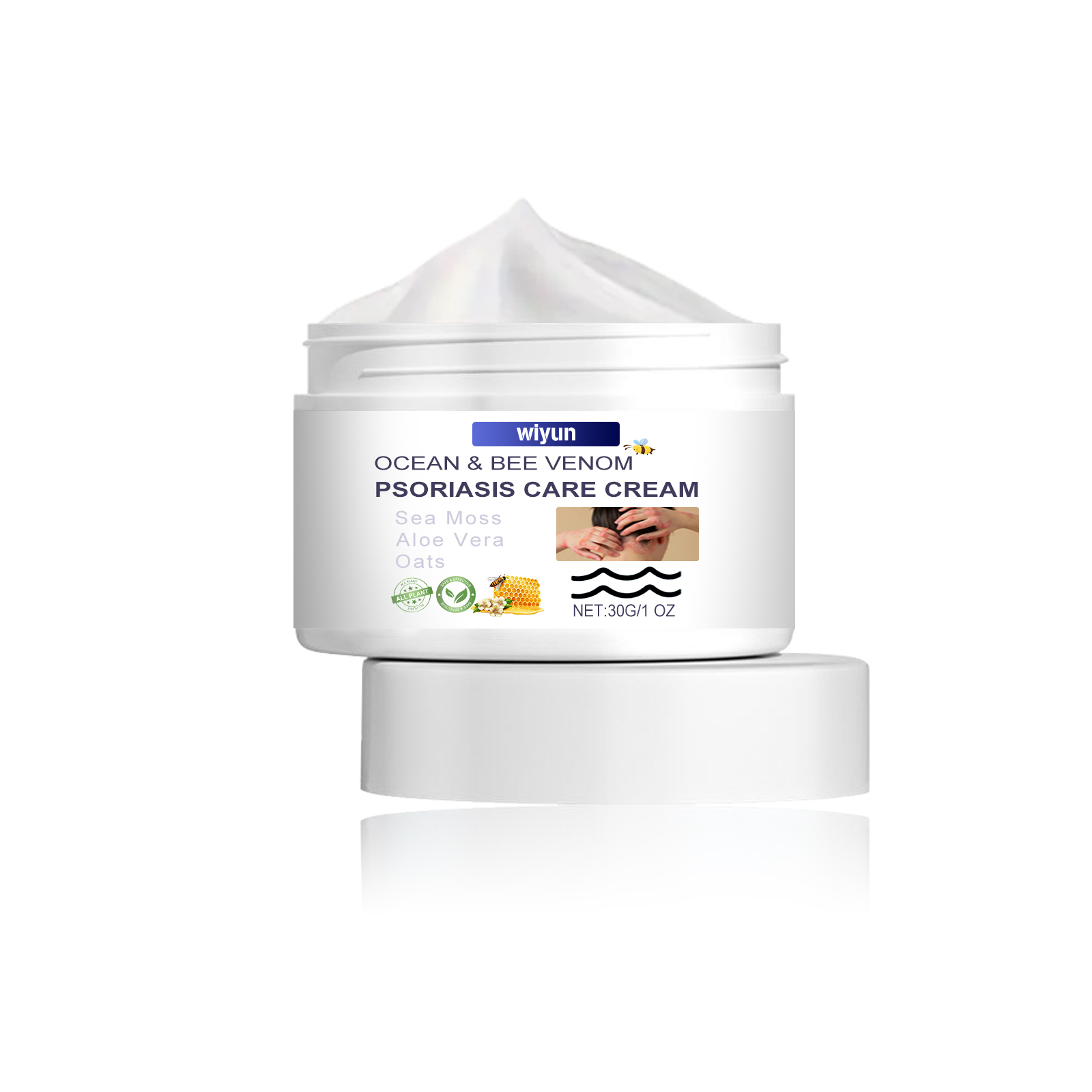 Psoriasis-Creme