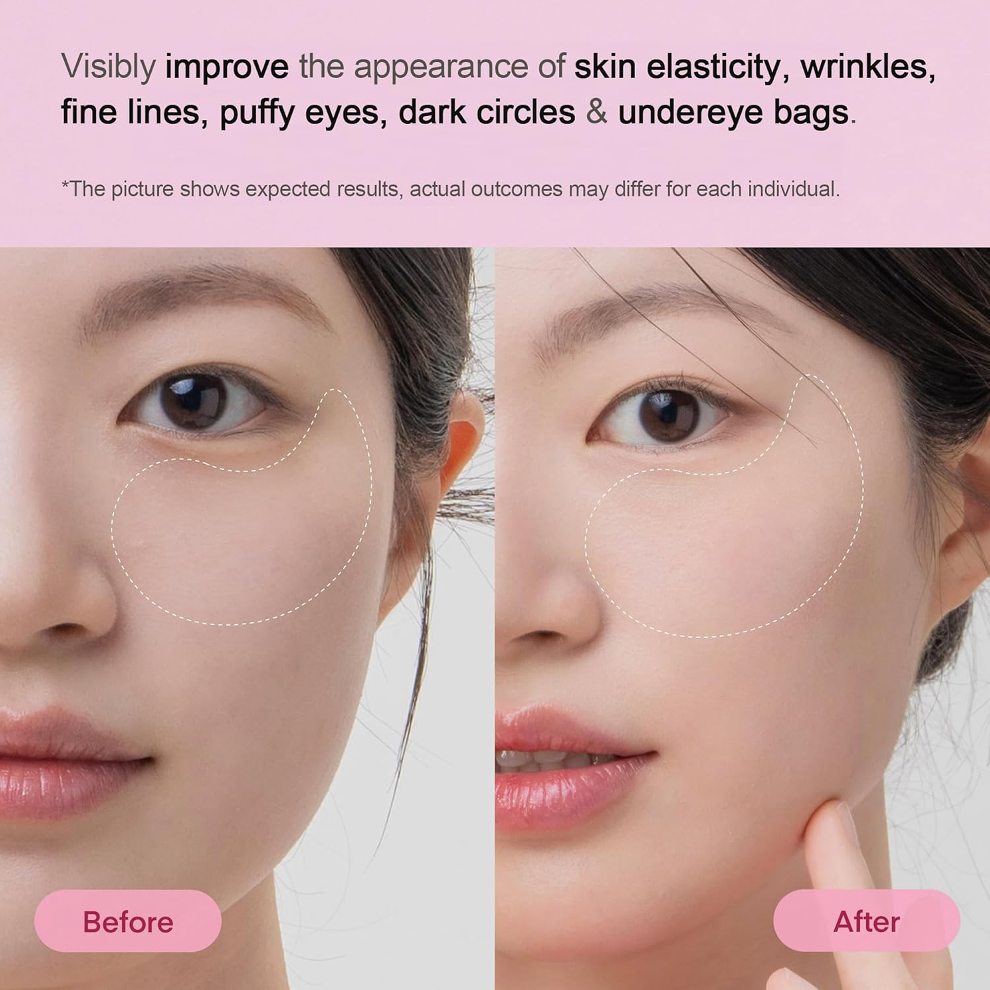 Augenpads Hydrogel 4