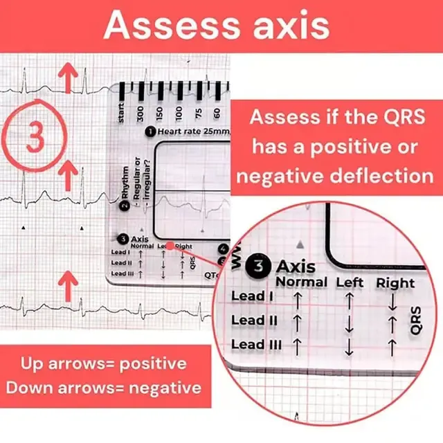EKG-Messlinealkarte 3