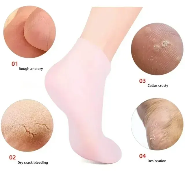 Fuss-Peeling-Socken 4