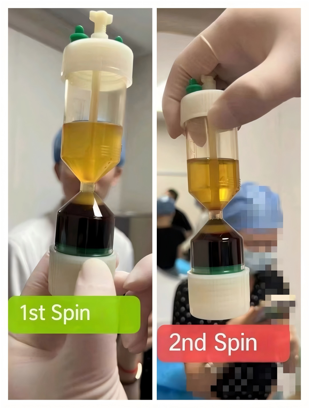 30 ml Zentrifugen-Kit für Hautregeneration 3
