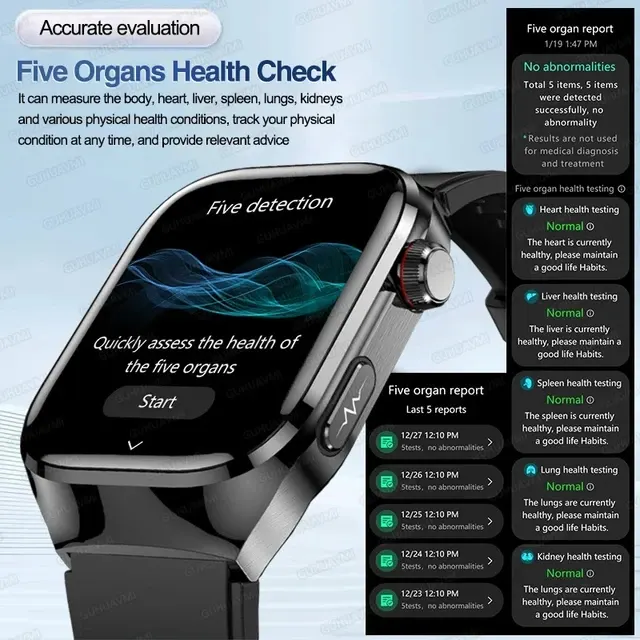 EKG-Smartwatch 4