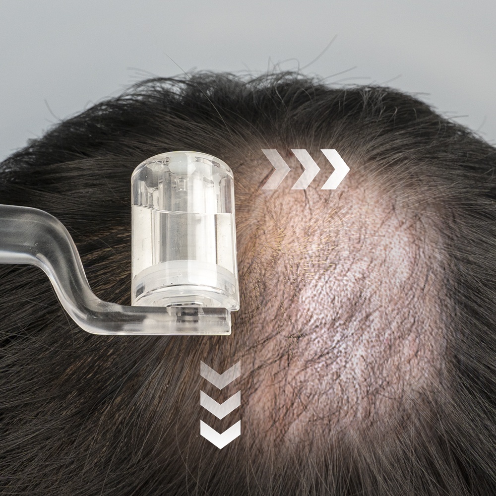 Tragbarer Derma Roller 0,25 mm für Haar- und Bartwuchs